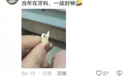 拔智齿视频,视频带你直观体验